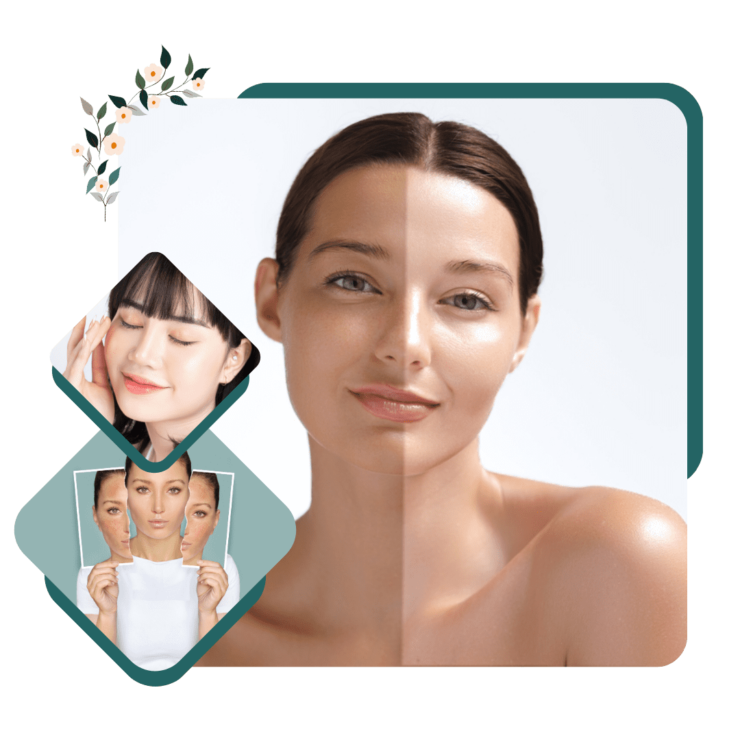 FAIR SKIN/ SKIN WHITENING